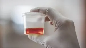 publive-image