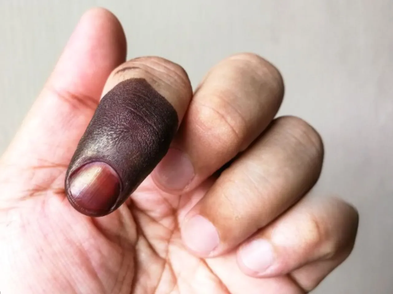 indelible ink story