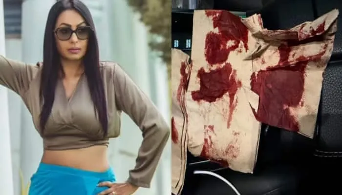 Actress Kashmera Shah Meets With Accident; Says 'Thank u god...'