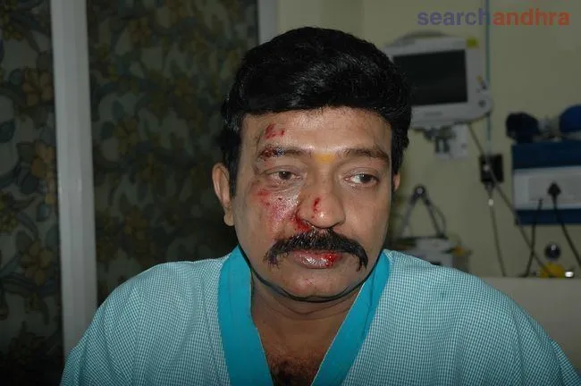 तीन फिल्म फेयर अवॉर्ड्स जीत चुकें एक्टर राजाशेखर की कार का हुआ एक्सीडेंट