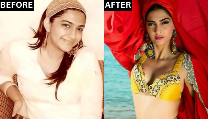sonam kapoor before after picture