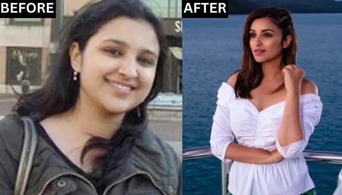 parineeti chopra before after picture