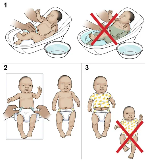 Step-by-Step: Caring for Your Newborn's Umbilical Cord | Saint Luke's  Health System