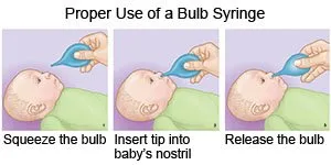 How to Use A Bulb Syringe - What You Need to Know