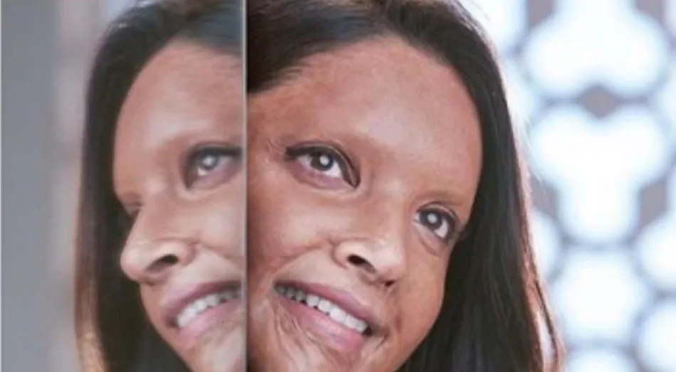 chhapaak