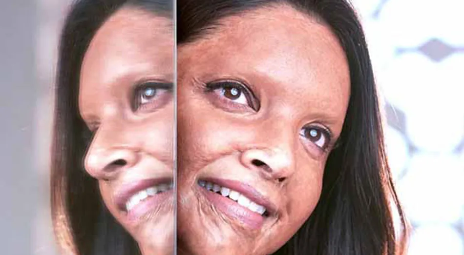 Chhapaak Review