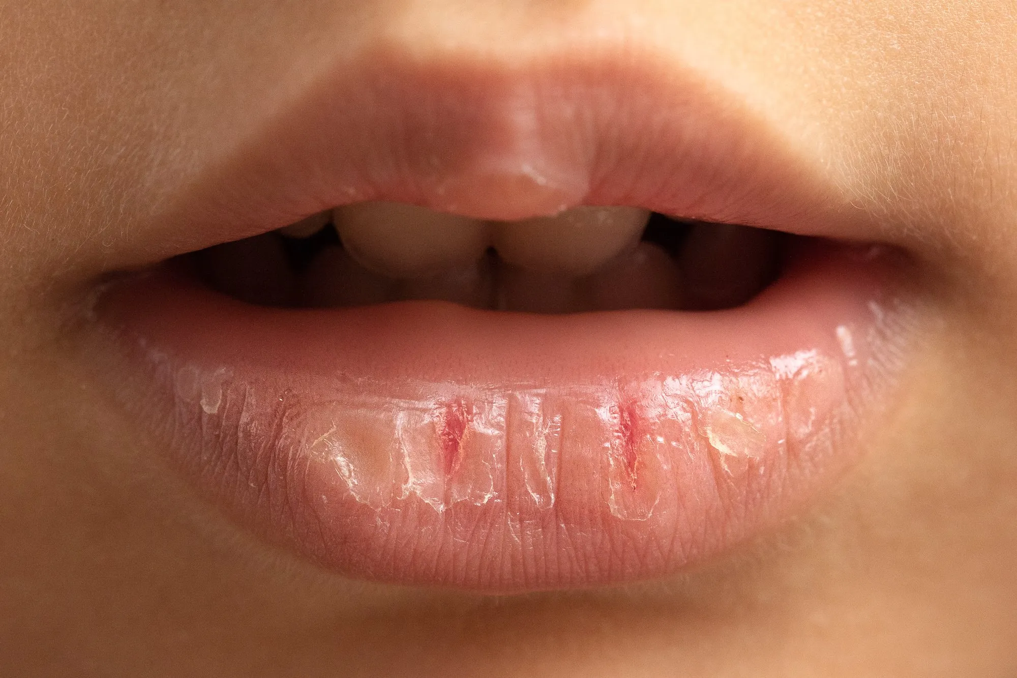 AdobeStock 307898897 2048x 