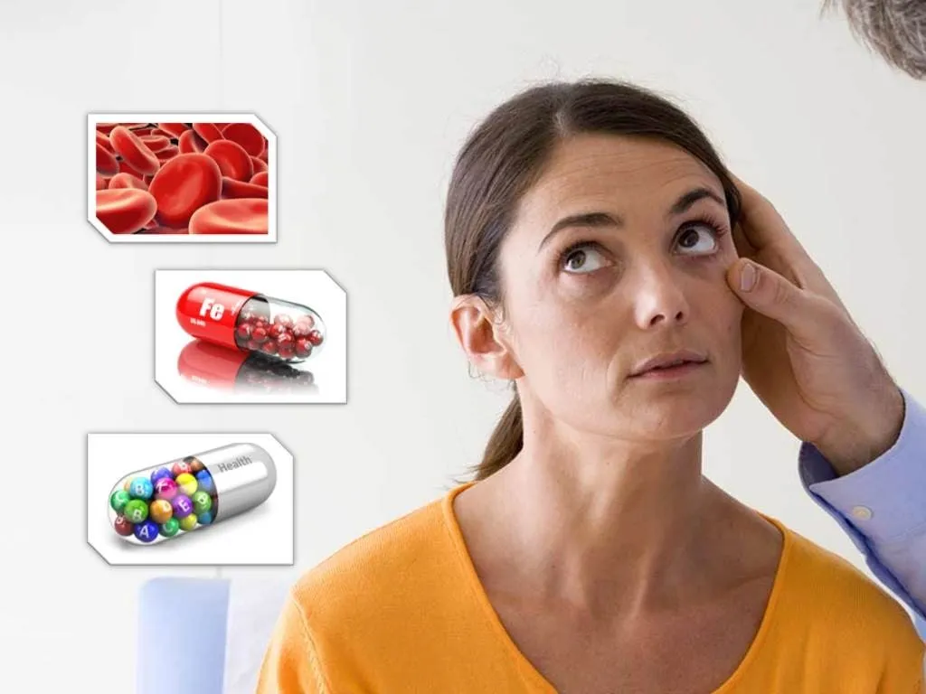anemia 