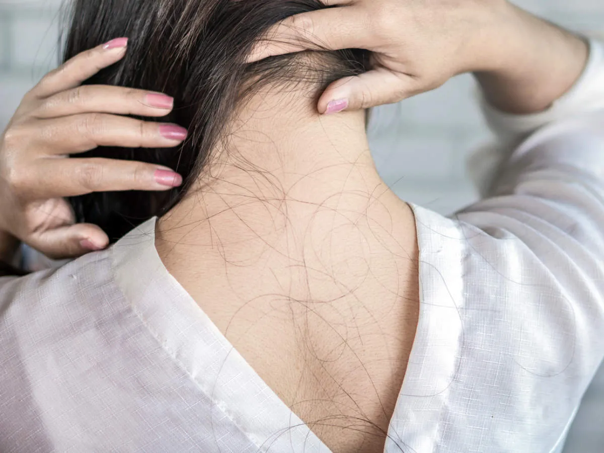 common mistakes of hairfall 