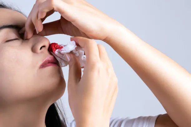 nosebleeds