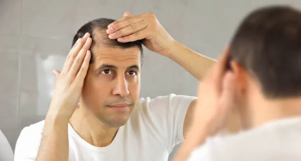 hair loss problem