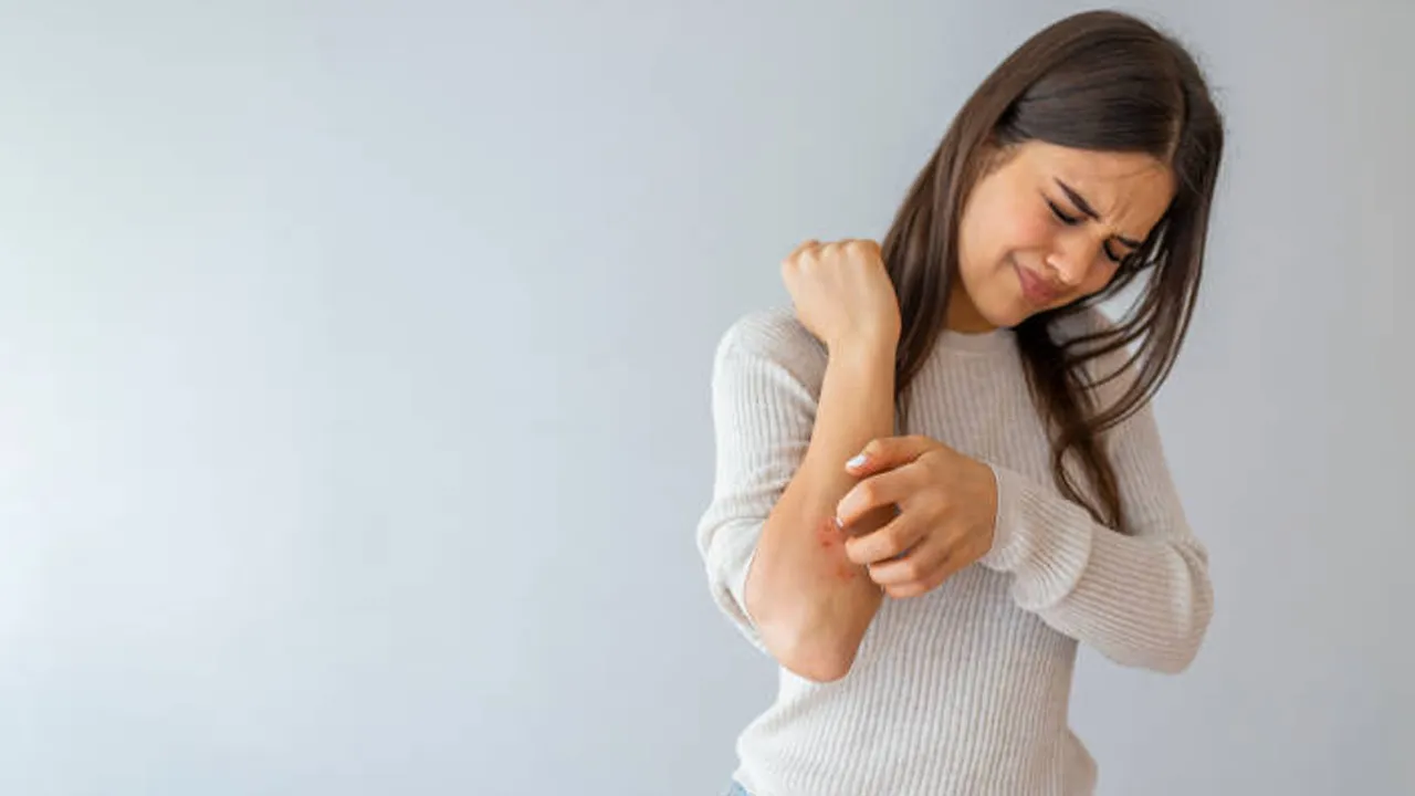 itching home remedies