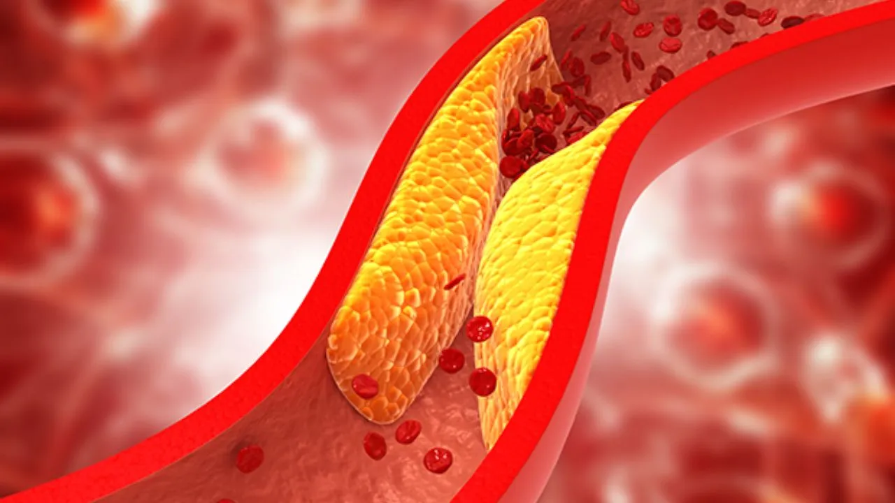 cholesterol 