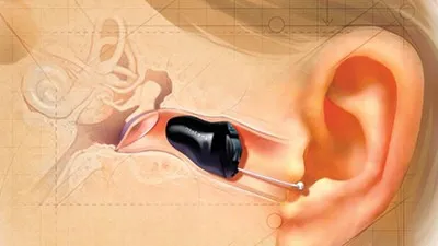 Hearing Aids
