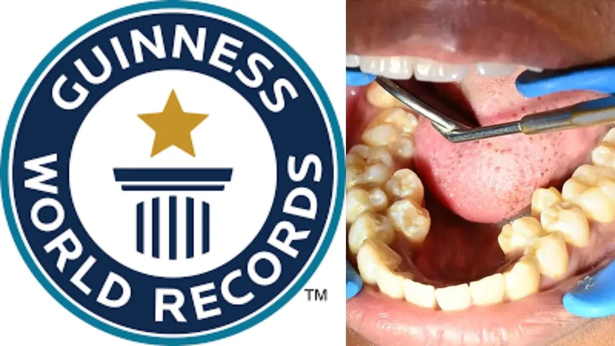 Meet Kalpana Balan, 26-Year-Old Mother With 38 Teeth Sets Guinness World  Record