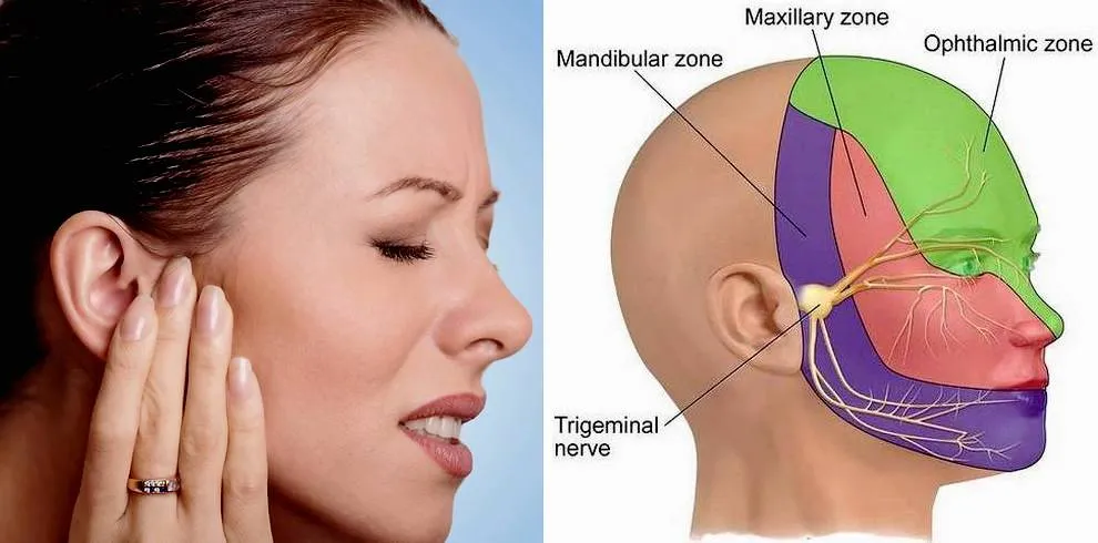 Trigeminal Neuralgia Treatment In London | Harley Street Clinic