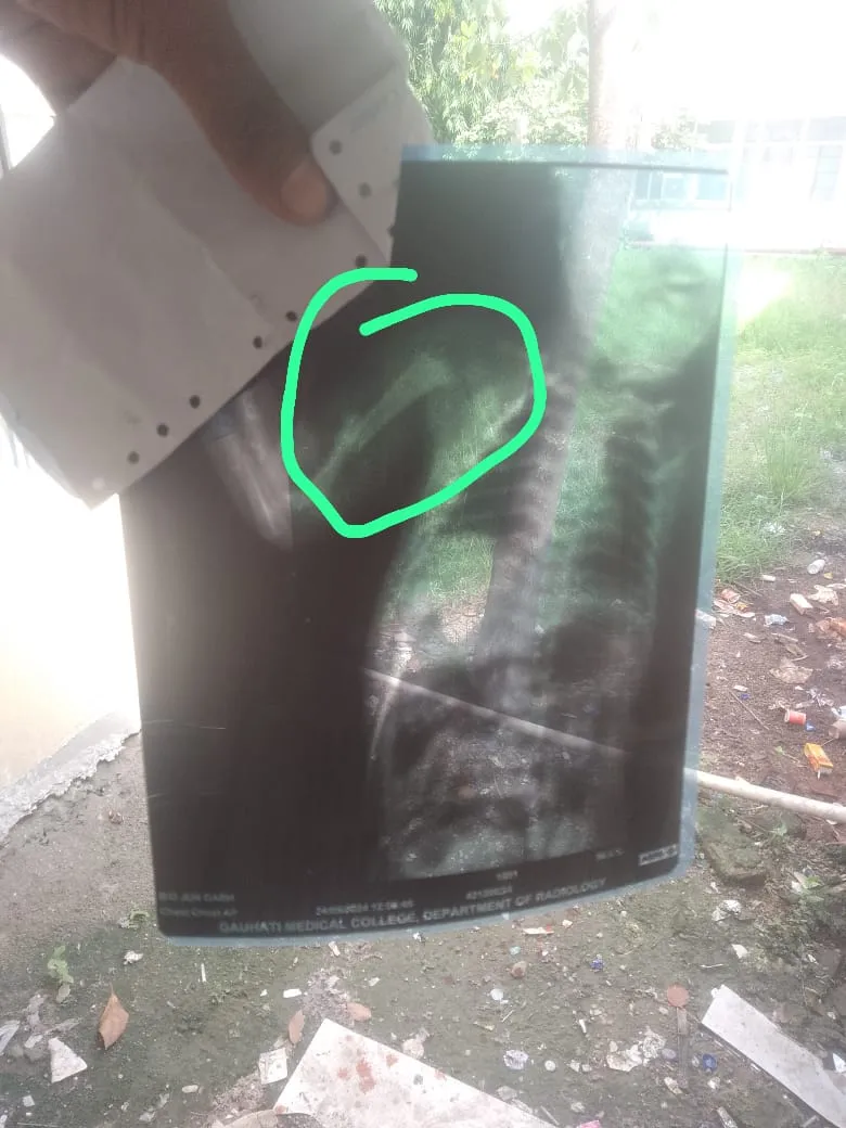 The X ray report  