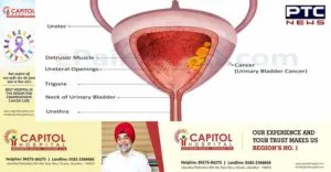 Punjab Blood cancer Basic Symptoms