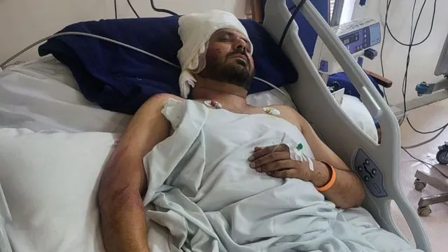 Yo Yo Honey Singh's brother Alfaaz Singh attacked; singer asks his fans to pray for him