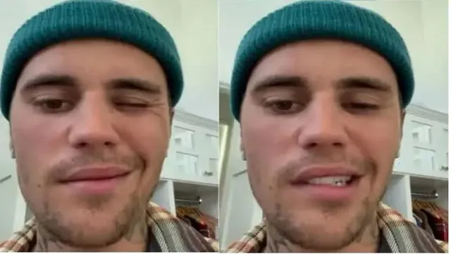 Justin Bieber opens up about his facial paralysis; says, 'Eye isn't blinking, can't smile' <Watch Video>