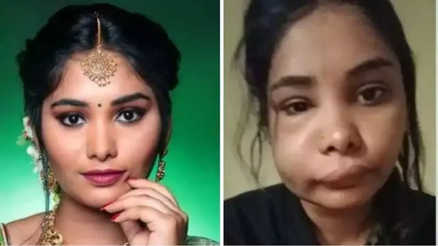 Kannada actress Swathi Sathish gets swollen face after root canal surgery, pictures go viral