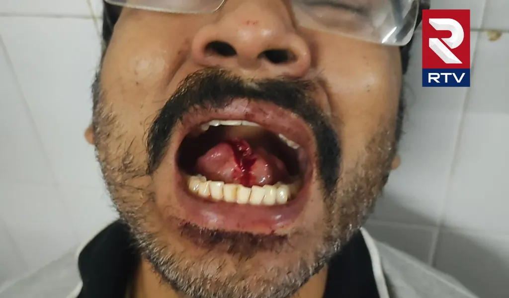 Wife cut Husband Private Parts