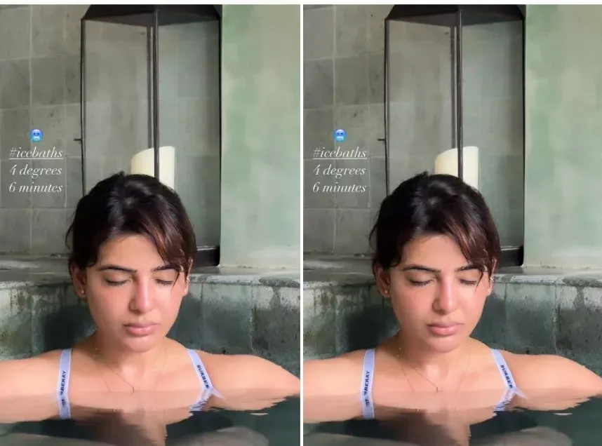 samantha ice therapy