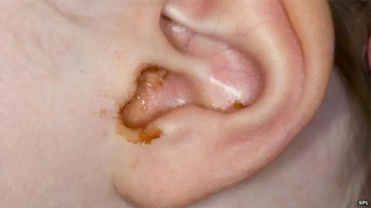 publive-image
