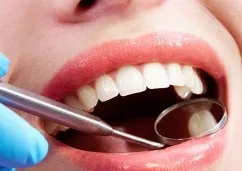 dental-filling