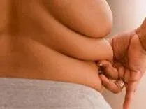 Obesity