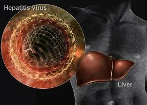 hepatitis-virus
