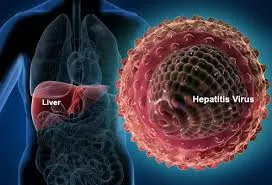 Viral hepatitis