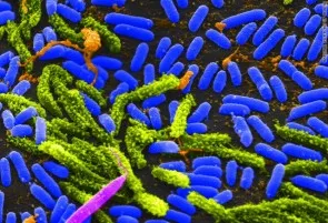 Cholera bacteria