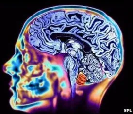 Brain scan