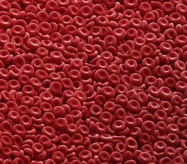 B0006424 Red blood cells Credit: Annie Cavanagh. Wellcome Images images@wellcome.ac.uk http://images.wellcome.ac.uk Red blood cells clearly showing their biconcave disc shape. Scanning electron micrograph 2006 Published:  -  Copyrighted work available under Creative Commons by-nc-nd 2.0 UK, see http://images.wellcome.ac.uk/indexplus/page/Prices.html