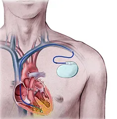 (courtesy:www.nutralegacy.com)