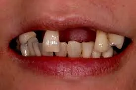 (courtesy:www.sammutspecialists.com)