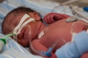 (Pic courtesy: www. qualityhealthguides.com)