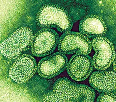 swine flu virus