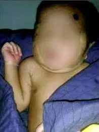 child