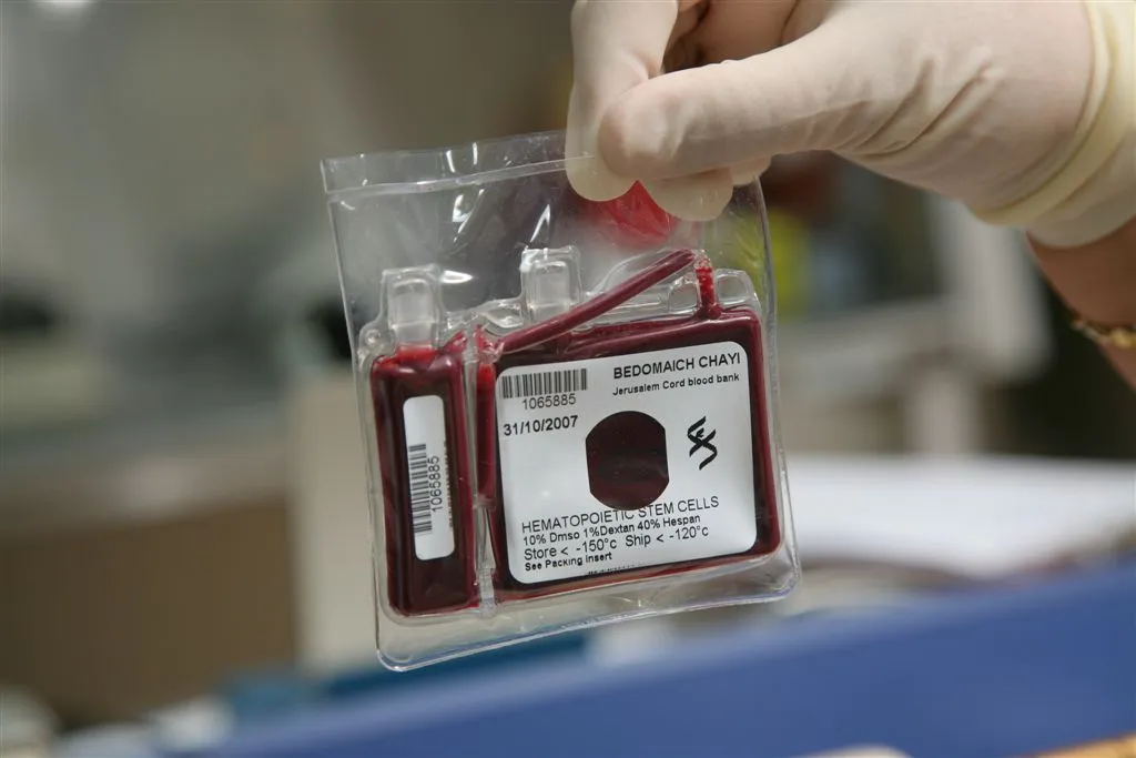 Pic Courtesy: www.cordblood.org.il