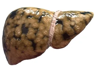 pic: baligadiagnostics.com