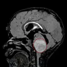 pic: www.sciencedaily.com
