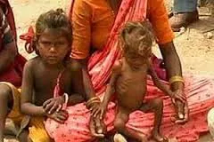 malnourished children