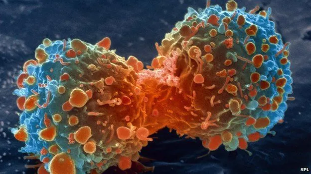 photo:bbc.co.uk