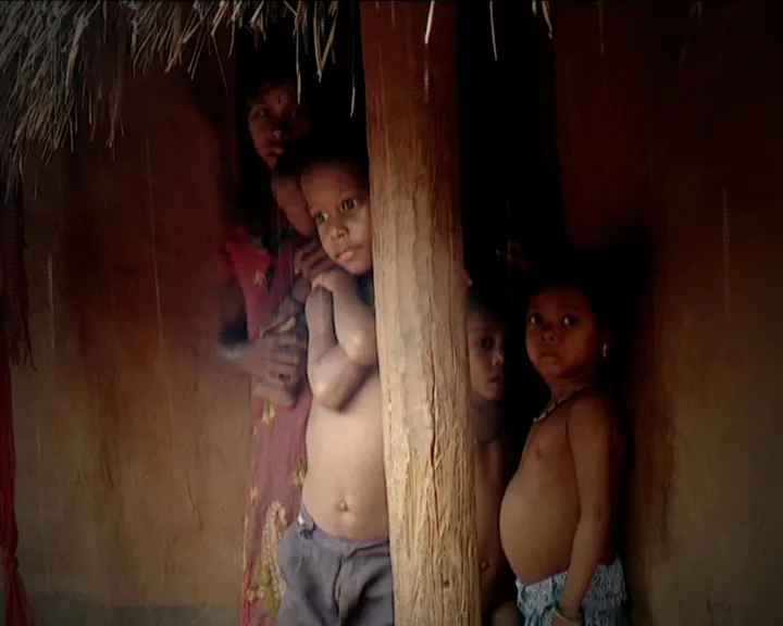 Nagada malnutrition