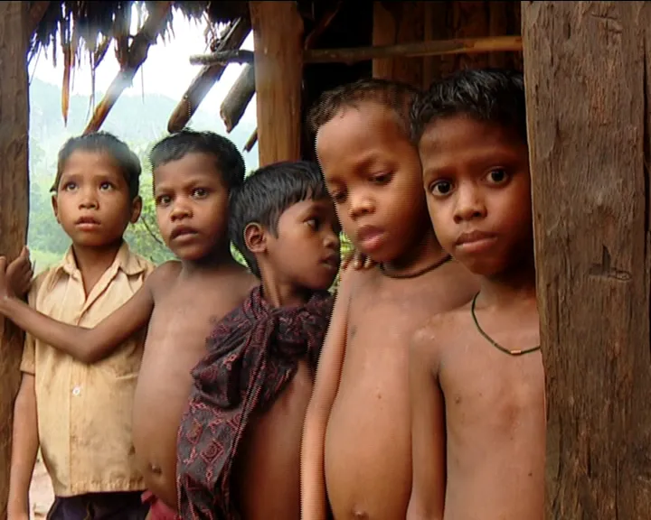 malnourished children nagada
