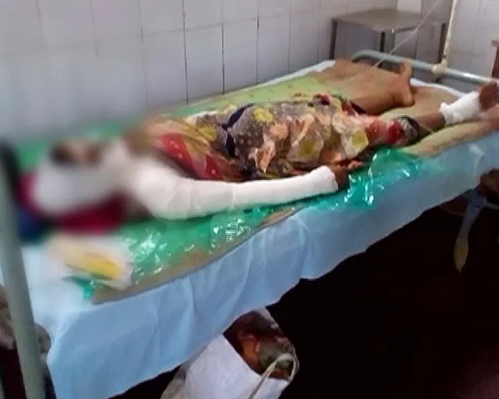 Gangpur acid attack victim 1