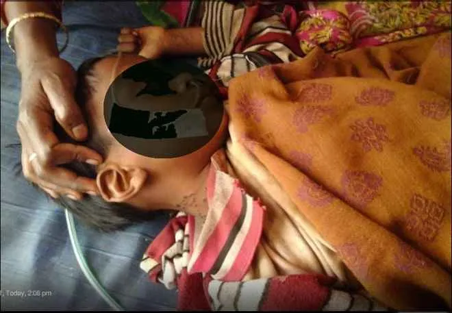 keonjhar-child-branding