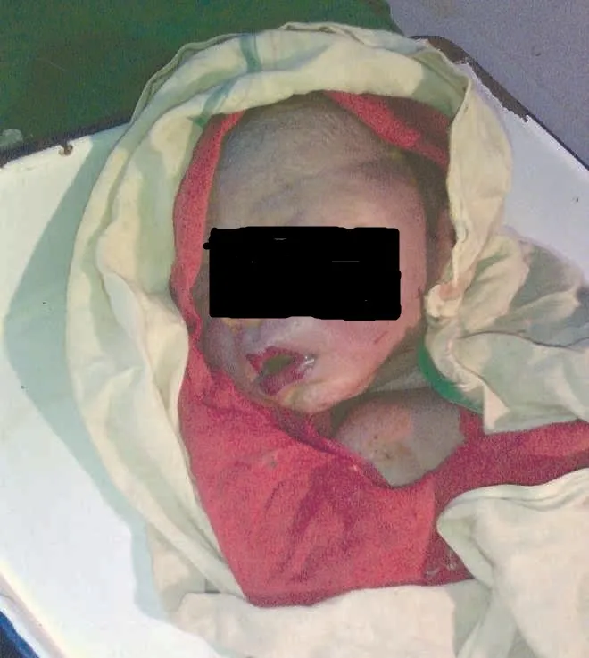 new-born-baby